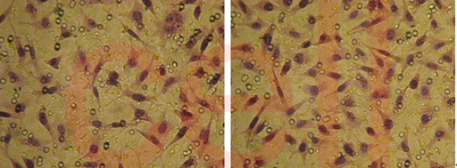 RNA干扰整体实验服务, RNAi基因干扰, SiRNA实验, RNAi RNA干扰整体实验服务, RNAi基因干扰, SiRNA实验, RNAi