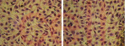 RNA干扰整体实验服务, RNAi基因干扰, SiRNA实验, RNAi RNA干扰整体实验服务, RNAi基因干扰, SiRNA实验, RNAi