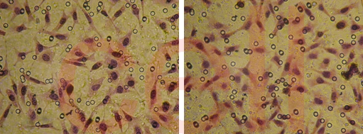 RNA干扰整体实验服务, RNAi基因干扰, SiRNA实验, RNAi RNA干扰整体实验服务, RNAi基因干扰, SiRNA实验, RNAi