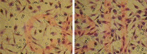 RNA干扰整体实验服务, RNAi基因干扰, SiRNA实验, RNAi RNA干扰整体实验服务, RNAi基因干扰, SiRNA实验, RNAi