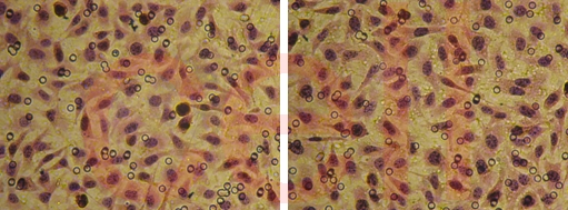 RNA干扰整体实验服务, RNAi基因干扰, SiRNA实验, RNAi RNA干扰整体实验服务, RNAi基因干扰, SiRNA实验, RNAi