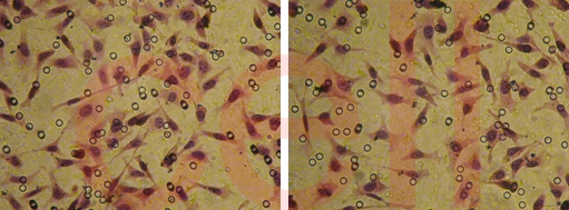 RNA干扰整体实验服务, RNAi基因干扰, SiRNA实验, RNAi RNA干扰整体实验服务, RNAi基因干扰, SiRNA实验, RNAi