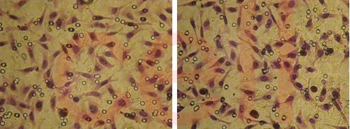 RNA干扰整体实验服务, RNAi基因干扰, SiRNA实验, RNAi RNA干扰整体实验服务, RNAi基因干扰, SiRNA实验, RNAi