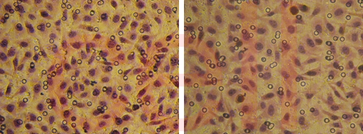 RNA干扰整体实验服务, RNAi基因干扰, SiRNA实验, RNAi RNA干扰整体实验服务, RNAi基因干扰, SiRNA实验, RNAi